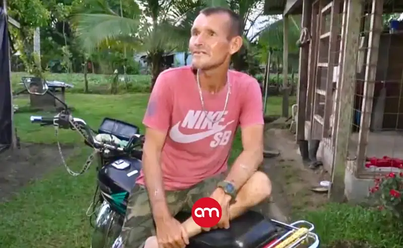 ”Pensé que me sacaba las tripas”: víctima de ataque de perezoso rompe el silencio