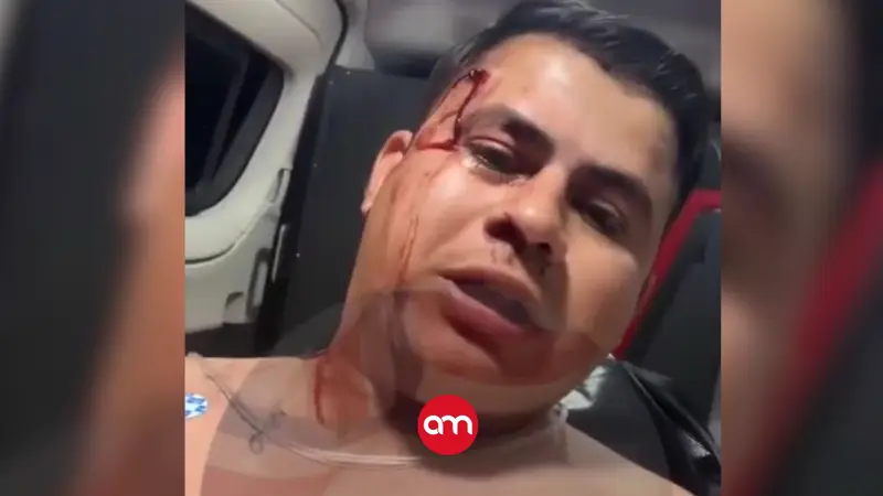 En pleno traslado en ambulancia, policía baleado narra detalles del tiroteo