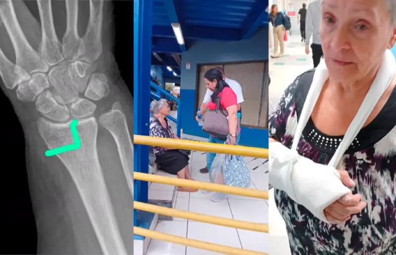 Adulta mayor se fractura al bajar de un bus de Lumaca en la terminal de Cartago