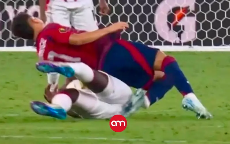 ¡Fuerzas, Warren! Jugador deberá ser operado tras fractura sufrida con la Sele