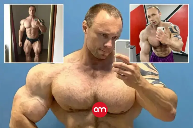 Muere ‘el Popeye ruso’: su cuerpo colapsa tras años de inyecciones extremas