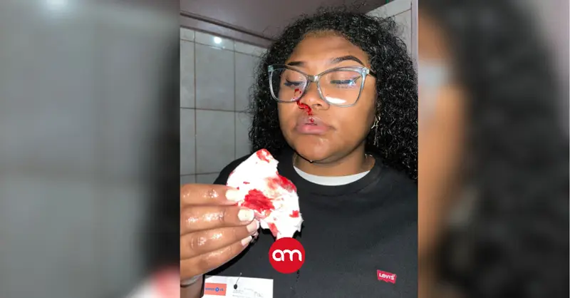 (Video) Joven agredida en centro de votación de Cartago cuenta lo ocurrido