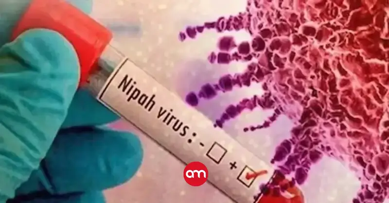 Salud descarta alerta internacional por virus Nipah y mantiene vigilancia en el país