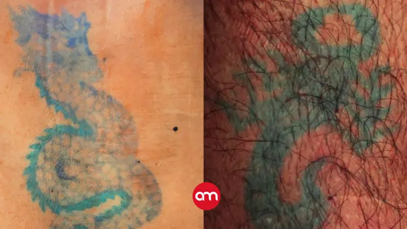 Un dragón y un escorpión: los únicos detalles del OIJ para identificar a un hombre que murió atropellado