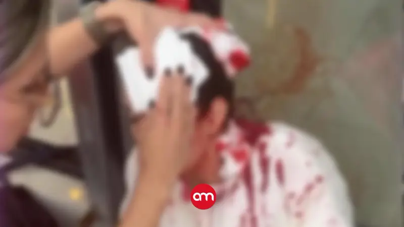 ¡Cobarde! Hombre ataca brutalmente a martillazos a veterinaria en Cartago