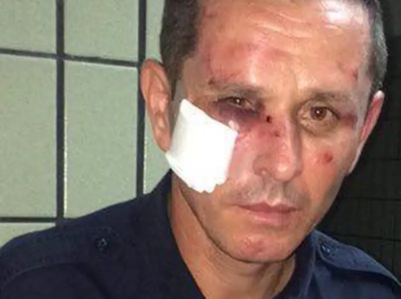 Policía agredido por vándalos en San Carlos: "Sentí miedo mientras pateaban mi rostro"